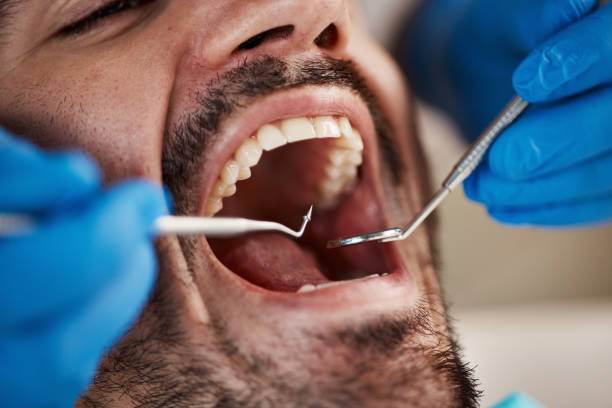 Best Knocked-Out Tooth Emergency  in Saybrook Manor, CT